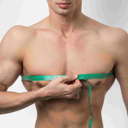 gynaecomastia